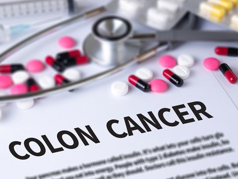 Colon Cancer - On the Wrong Side of 40